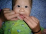 AJ's First Teeth